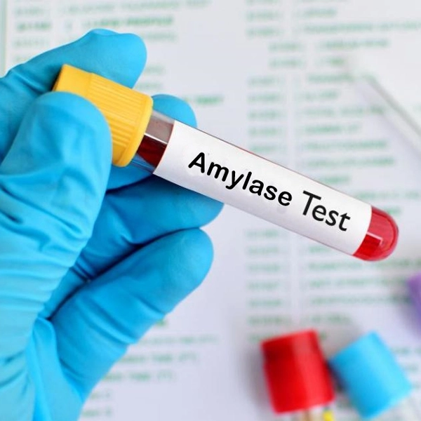 एमाइलेज टेस्ट क्या है? | Amylase Test in Hindi