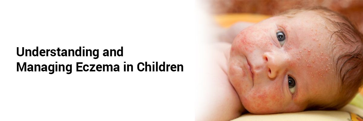 Understanding and Managing Eczema in Children