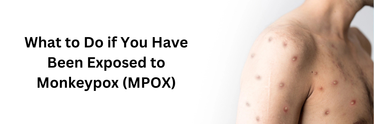 What to Do if You Have Been Exposed to Monkeypox (MPOX)