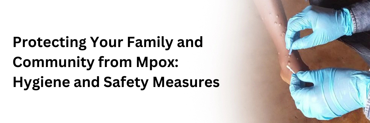 Protecting Your Family and Community from Mpox: Hygiene and Safety Measures