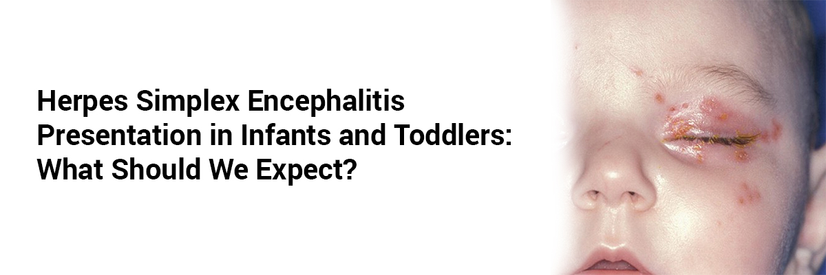Herpes Simplex Encephalitis presentation in Infants and Toddlers: what should we expect?