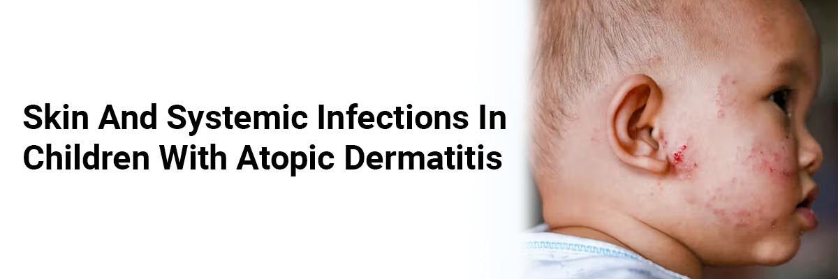 Skin and Systemic Infections in Children with Atopic Dermatitis