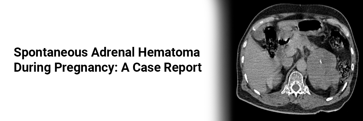 Spontaneous Adrenal Hematoma During Pregnancy: A Case Report