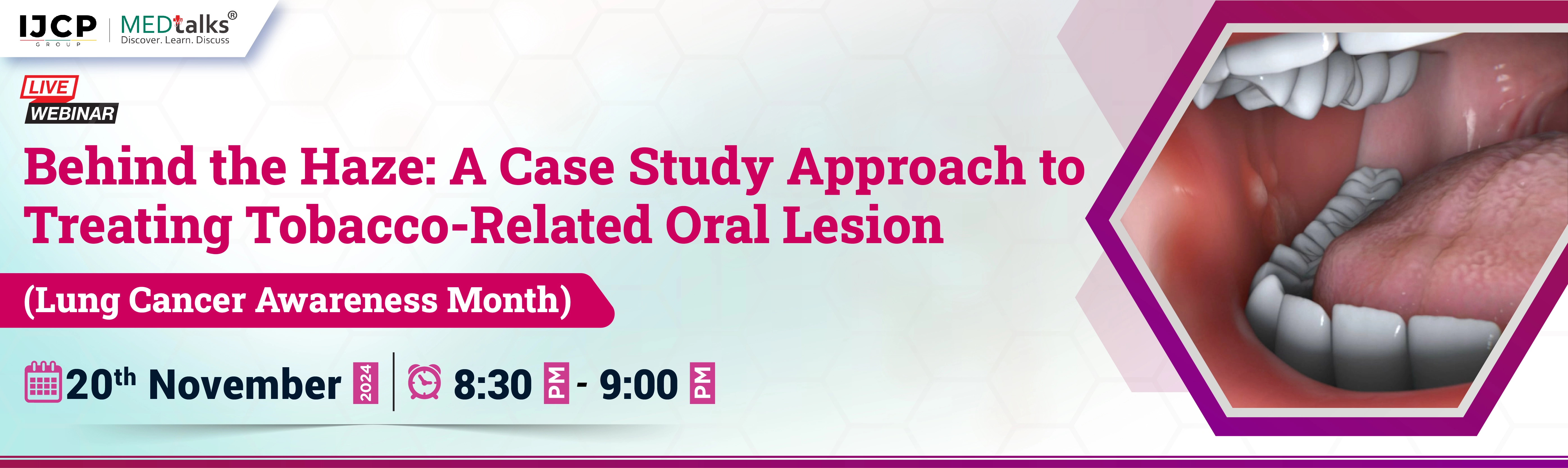 Behind the Haze: A Case Study Approach to Treating Tobacco-Related Oral Lesion (Lung Cancer Awareness Month)