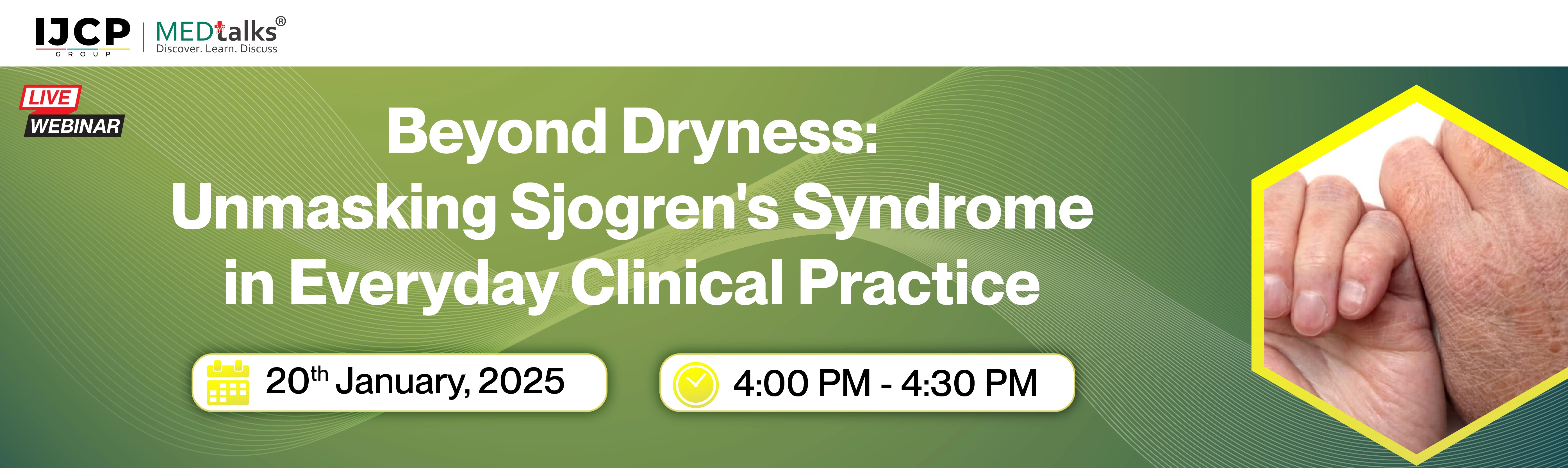 Beyond Dryness: Unmasking Sjogren's Syndrome in Everyday Clinical Practice